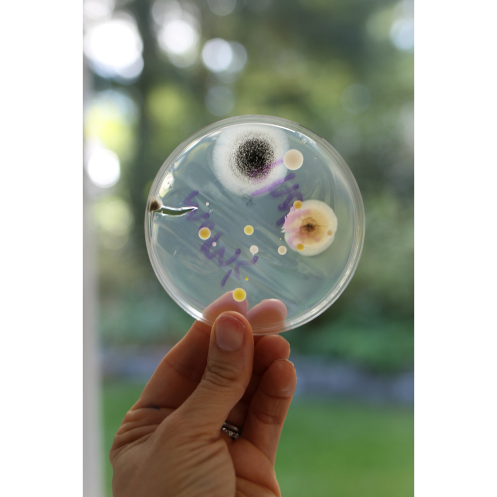 petri dish bacteria growth